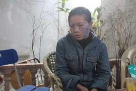 Chỉ vì đa cấp, chồng tra tấn vợ dã man như thời trung cổ