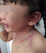 Nói cha dượng 'hút xì ke', bé 3 tuổi bị đánh ngất xỉu