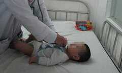 Hãi hùng phát hiện tụ điện trong phế quản bé 8 tháng tuổi