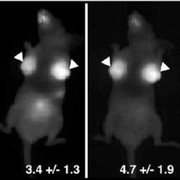 Phương pháp phát hiện nhanh tế bào ung thư vú