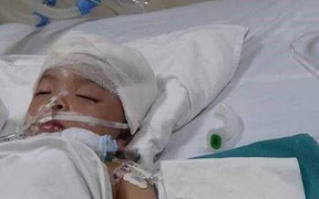 Bị kẹt thành giường, bé gái ngạt thở, hôn mê