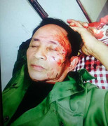 Cán bộ xã đánh ông già 68 tuổi rách mặt, be bét máu