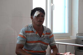 Cán bộ bảo vệ rừng bị lâm tặc đánh trọng thương