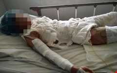 'Ăn bớt' tiền mua rượu để mua thức ăn cho con, vợ bị chồng đốt chết