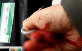 Phó Thủ tướng Nguyễn Xuân Phúc 'lệnh' xử nghiêm vụ nhà báo Đỗ Doãn Hoàng bị đánh dã man