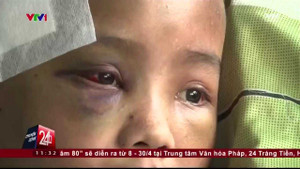 Clip: Chàng trai bị sán heo làm tổ trong não gần 2 năm