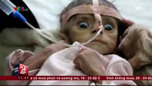 Ám ảnh khôn cùng khi xem bức ảnh bé trai chết đói ở Yemen