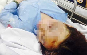 Bắt 'nữ quái' cầm đầu vụ tạt axit nữ sinh