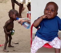 Thân hình mập mạp khó tin của cậu bé sắp chết đói cách đây 2 tháng