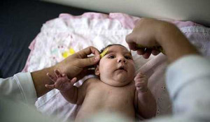 Chỉ phụ nữ mang thai 3 tháng đầu, virus Zika mới có khả năng gây đầu nhỏ