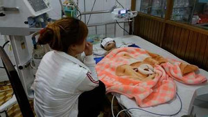 Bé 25 tháng tuổi ngã ở nhà trẻ 'chui': Sự sống đang rất mong manh