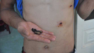 Phó công an xã bị tố cáo bắn 4 phát đạn vào dân