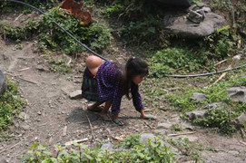 Em bé 'người vượn' ở thâm sơn: Lãnh đạo huyện rốt ráo chỉ đạo hỗ trợ