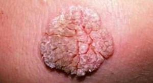 Bác sĩ sốc với ‘cậu nhỏ’ biến dạng khiếp sợ