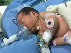 Hành trình vượt 1000km cứu sống bệnh nhi 3 ngày tuổi