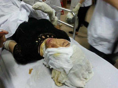 Nổ rung chuyển tại Nghệ An, la liệt người bị thương: Xác định nguyên nhân ban đầu