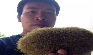 Giải mã sỏi mật 'trứng vàng' trong bụng lợn trị giá bạc tỷ