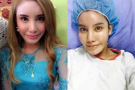 Đại gia bạo tay mở hầu bao để chuyển giới