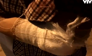 Video: Phóng viên VTV24 bị chém trong khi tác nghiệp