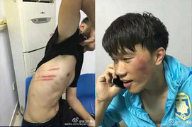 Trung Quốc: Đội bóng triệu USD bị đánh sưng mặt