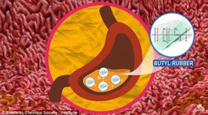 Cơ thể sẽ ra sao khi bạn nuốt phải bã kẹo cao su?