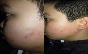 Chủ tịch Hà Nội yêu cầu xử nghiêm cô giáo bắt 40 học sinh tát bạn