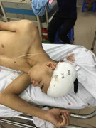 50 côn đồ xông vào nhà dân chém người túi bụi