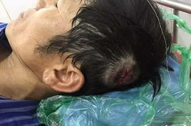 Côn đồ hung hãn xông vào đuổi chém 11 công nhân đang làm việc