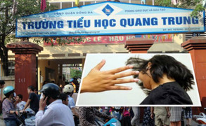 Cô giáo 'lệnh' học sinh tát bạn: Đến lúc phải kiểm soát quyền lực ở trường học