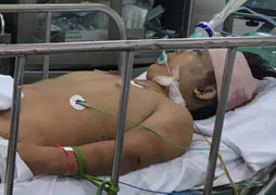 Thiếu niên 17 tuổi rơi xuống sông chấn thương sọ não khi 'đi bão' cổ vũ bóng đá