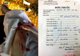 Khi bất ngờ bị phơi nhiễm HIV cần xử lý thế nào?