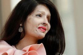 Tấn công bằng axit - vấn nạn khiến thế giới vùng vẫy kêu khóc