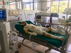 Người đàn ông tẩm xăng đốt 5 người một nhà: Sức khỏe các nạn nhân giờ ra sao?