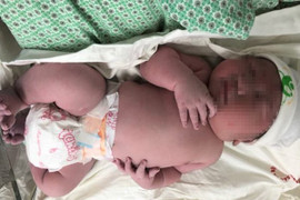 Vừa chào đời, bé trai Hà Nội nặng hơn 5 kg