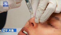 Tự tiêm botox mua trên mạng, hai cô gái suýt mù