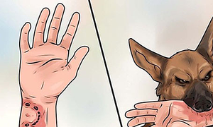 Bé trai lên cơn dại và qua đời sau hai tháng bị chó cắn