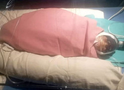 Cụ bà 75 tuổi ở Ấn Độ sinh con nặng 600g