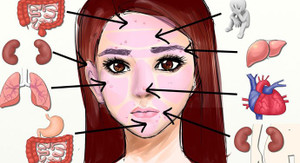 Bắt bệnh cực chuẩn với 7 vị trí mọc mụn trên mặt