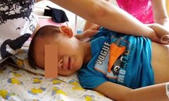Con mắc sỏi niệu quản, tràn dịch thận vì mẹ bổ sung canxi quá mức