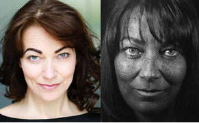 Bị ung thư da ác tính, nữ diễn viên tiết lộ nguyên nhân đáng sợ