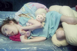 Nhận 'nụ hôn thần chết' từ người bạn của bố mẹ, bé gái tê liệt suốt 13 năm