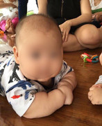 Hà Nội: Tưởng con sốt virus lâu ngày, người mẹ bàng hoàng khi biết con nhiễm virus ADENO gây hoại tử phổi