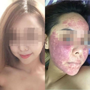 Bị mỹ phẩm phá nát mặt, cô gái phải dừng hôn lễ