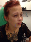 Cảnh báo nguy cơ mất thị giác hoàn toàn do trào lưu xăm tròng mắt