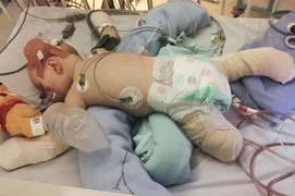 Cậu bé bị viêm màng não hồi phục kỳ diệu sau khi được chẩn đoán chỉ sống thêm vài giờ