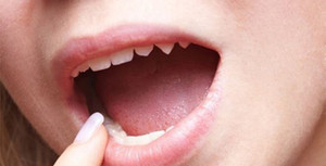 Lè lưỡi soi gương, nhìn màu lưỡi biết ngay bệnh cơ thể