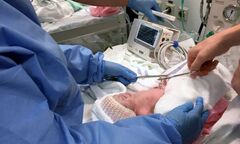 Kỳ diệu ca sinh 3 nhờ thụ tinh ống nghiệm, 1 bé còn nằm nguyên trong bọc ối