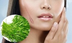 Bất ngờ: Rau muống không phải là 'thủ phạm' gây sẹo lồi