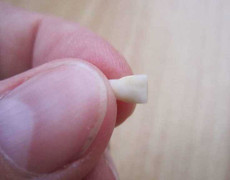 Có đúng là giữ lại răng sữa sẽ cứu được con bạn trong tương lai?