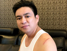 Nữ bác sĩ chuyển tiền cho người chém ông Chiêm Quốc Thái là ai?